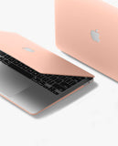 Pink Candy Hardshell Case for Macbook