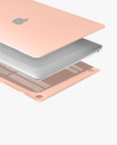 Pink Candy Hardshell Case for Macbook