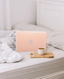 Pink Candy Hardshell Case for Macbook