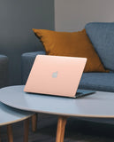Pink Candy Hardshell Case for Macbook